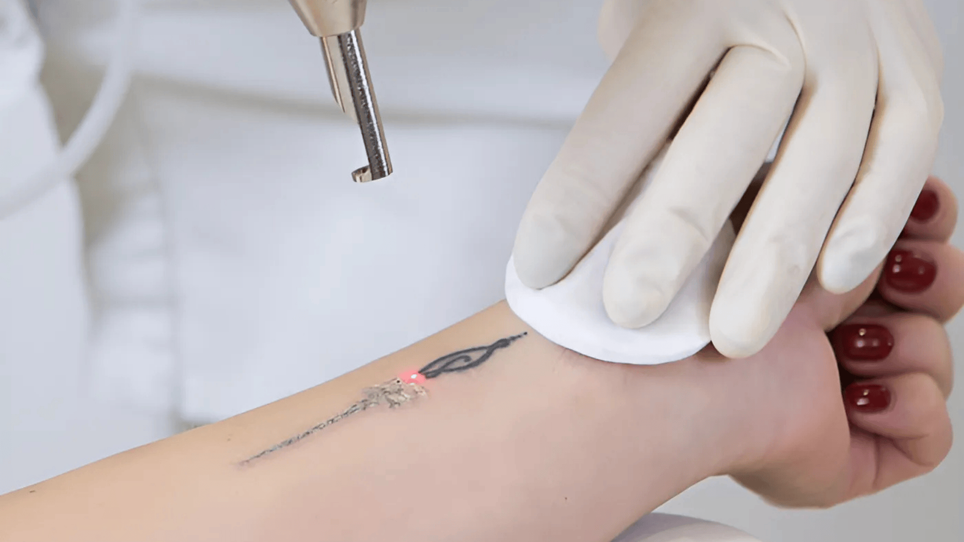 Pre-and-Post-Treatment-Skin-Care-for-Best-Results