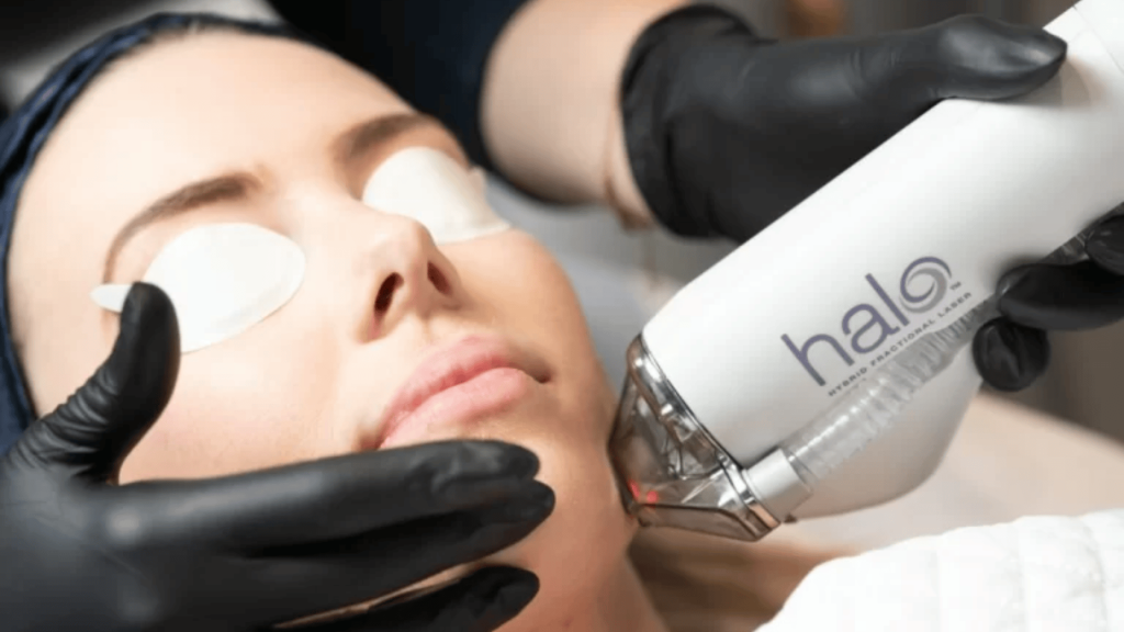 halo face treatment